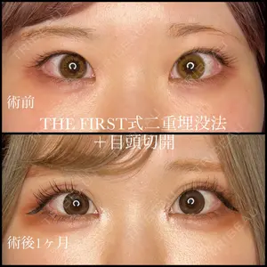 THE FIRST CLINIC 多摩センター院 惟村 公郁医師の症例