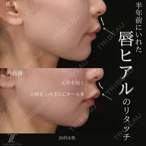 Zetith Beauty Clinic 福岡院 堂園 史子医師の症例