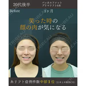 湘南美容クリニック 名古屋院 山本 高士医師の症例