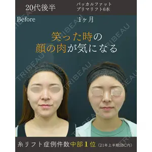 湘南美容クリニック 名古屋院 山本 高士医師の症例