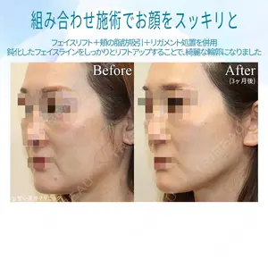 聖心美容クリニック 銀座院 牧野 陽二郎医師の症例