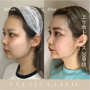 YVESJU CLINIC （イヴジュクリニック） 表参道院 佐々木 享医師の症例