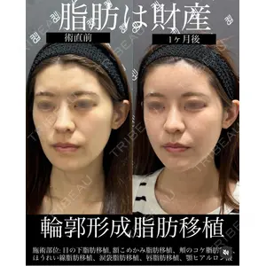 EMMO FACE CLINIC 大宮院 廣松 直樹医師の症例