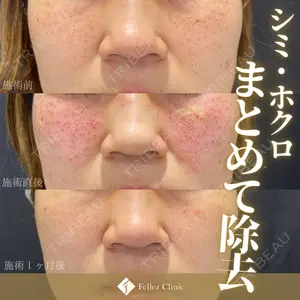 Fellez Clinic【フェルズクリニック】 小野 泰寛医師の症例