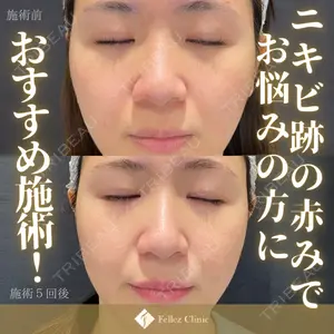 Fellez Clinic【フェルズクリニック】 小野 泰寛医師の症例