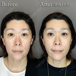 ハナビューティークリニック 崎尾怜子医師の症例