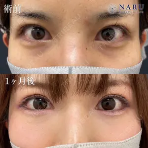 NARU Beauty Clinic 【ナルクリ】 地引 輔医師の症例