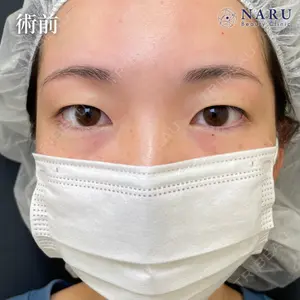 NARU Beauty Clinic 【ナルクリ】 地引 輔医師の症例