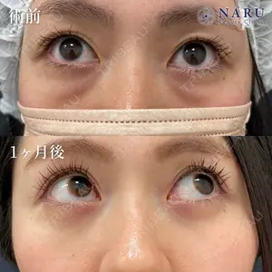 NARU Beauty Clinic 【ナルクリ】 地引 輔医師の症例