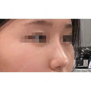LUHO（ルホ）美容外科 キム・ジュンヨン医師の症例