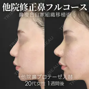 ジョウクリニック 銀座院 重本　譲医師の症例