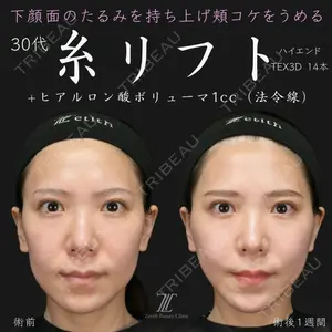 Zetith Beauty Clinic 福岡院 荻野 活医師の症例