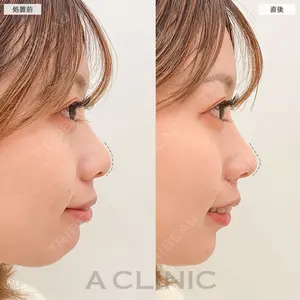A CLINIC（エークリニック） 名古屋院 住田 篤紀医師の症例