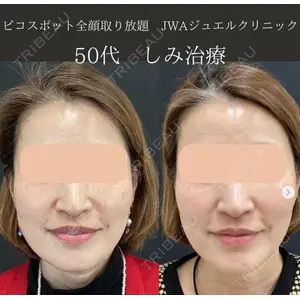 自由が丘ウェルエイジングビューティークリニック 福田 知佐子医師の症例