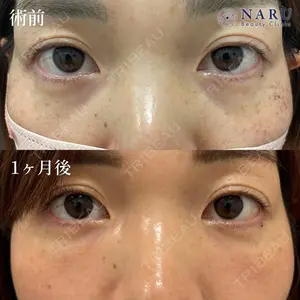 NARU Beauty Clinic 【ナルクリ】 地引 輔医師の症例