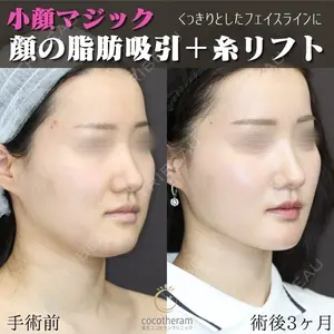 東京ココセランクリニック 篠﨑 智公医師の症例