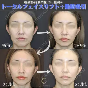 東京ココセランクリニック 篠﨑 智公医師の症例
