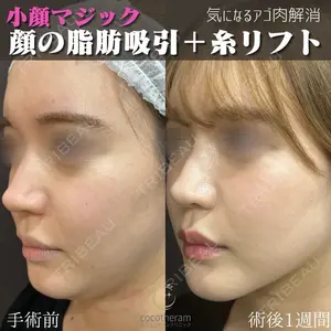 東京ココセランクリニック 篠﨑 智公医師の症例