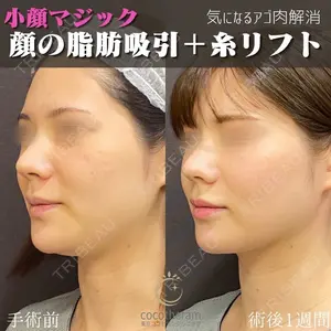 東京ココセランクリニック 篠﨑 智公医師の症例