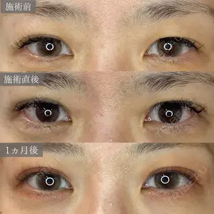 東京BELLEZZAクリニック 根本 尚久医師の症例
