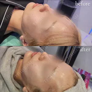Tokyo Tensei Clinic 新宿院の症例