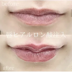 湘南美容クリニック 銀座院の症例