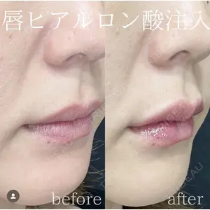 湘南美容クリニック 銀座院の症例