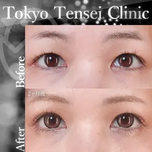 Tokyo Tensei Clinic 新宿院 沖津 勇気（ブレイブ沖津）医師の症例