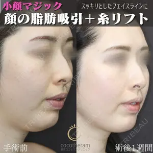 東京ココセランクリニック 篠﨑 智公医師の症例