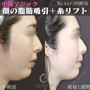 東京ココセランクリニック 篠﨑 智公医師の症例