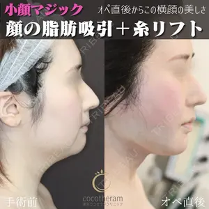東京ココセランクリニック 篠﨑 智公医師の症例