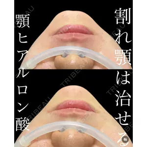 EMMO FACE CLINIC 大宮院 廣松 直樹医師の症例