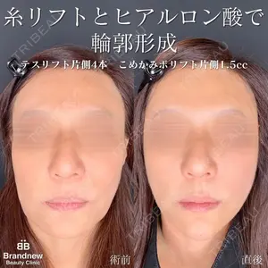 Brandnew Beauty Clinicの症例