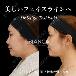 BIANCA銀座 雜賀 俊行医師の症例