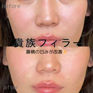 ルラ美容クリニック 仙台院 橋本 英樹医師の症例