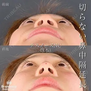 Brandnew Beauty Clinicの症例