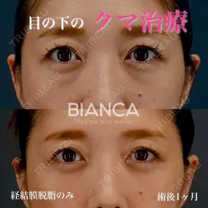 BIANCA銀座 雜賀 俊行医師の症例