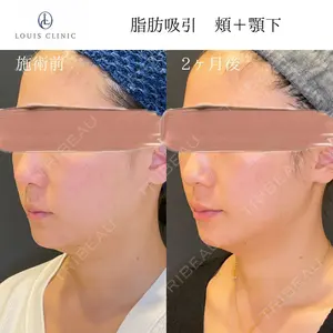 LOUIS CLINIC 二子玉川院【ルイクリニック】 小松 塁医師の症例