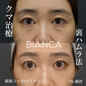 BIANCA銀座 雜賀 俊行医師の症例