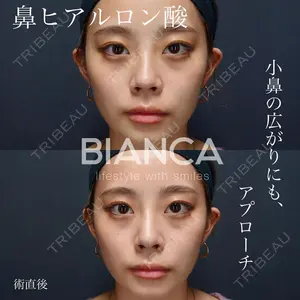 BIANCA銀座 雜賀 俊行医師の症例