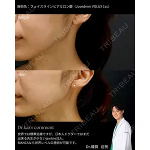 BIANCA銀座 雜賀 俊行医師の症例