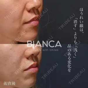 BIANCA銀座 雜賀 俊行医師の症例