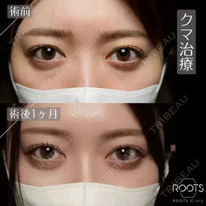 ROOTS Clinic 郭 天元医師の症例