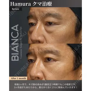 BIANCA銀座 服部 有美医師の症例