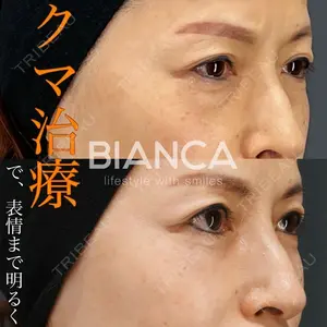 BIANCA銀座 服部 有美医師の症例