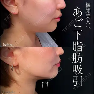 東京シンデレラ美容外科 池袋院 山本 紘子医師の症例