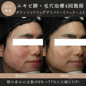 MIO CLINIC 梅田院の症例