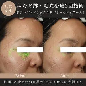 MIO CLINIC 梅田院の症例