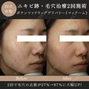 MIO CLINIC 梅田院の症例