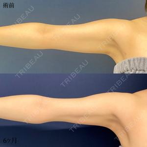 東京シンデレラ美容外科 大宮院の症例
